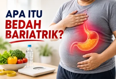 Apa Itu Bedah Bariatrik dan Bagaimana Cara Kerjanya?