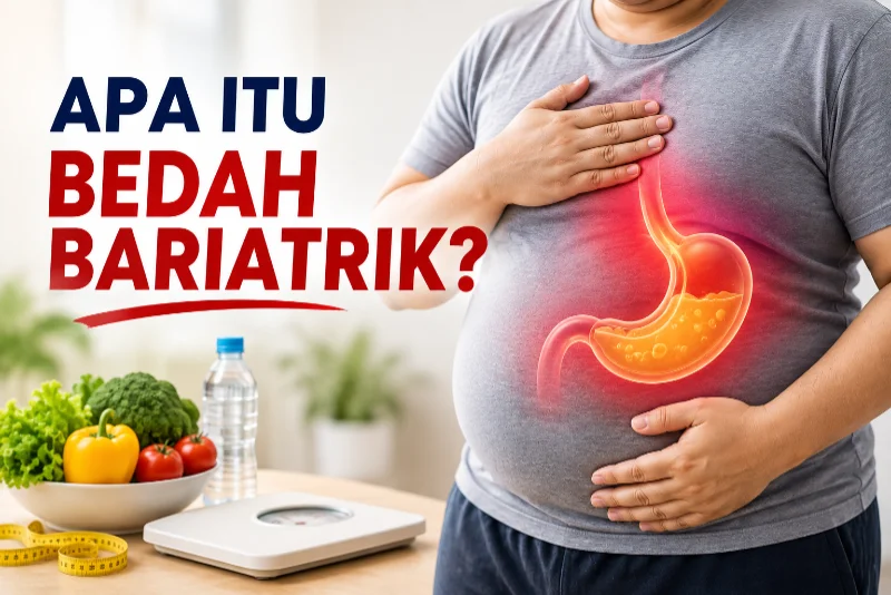 Apa Itu Bedah Bariatrik dan Bagaimana Cara Kerjanya?