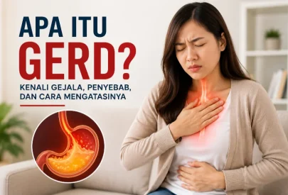 Apa Itu GERD? Kenali Gejala, Penyebab, dan Cara Mengatasinya