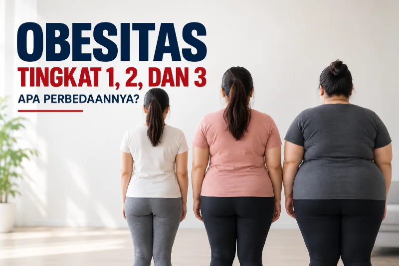 Obesitas Tingkat 1 2 dan 3 Apa Perbedaannya?